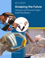 .Grasping the Future: Advances in Powered Upper Limb Prosthetics.